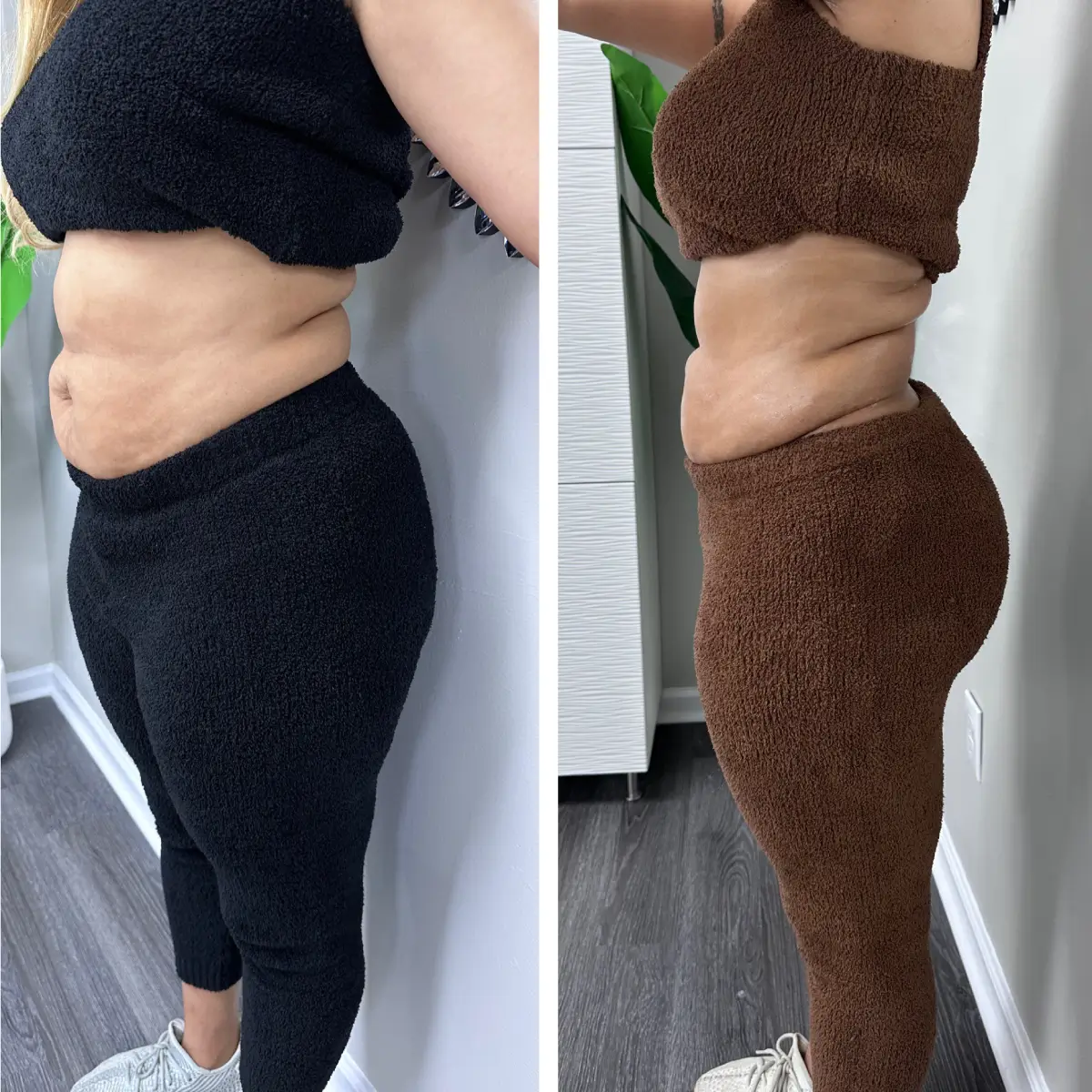 a woman wearing a black top and brown pants, lipodissolve graphic-offers