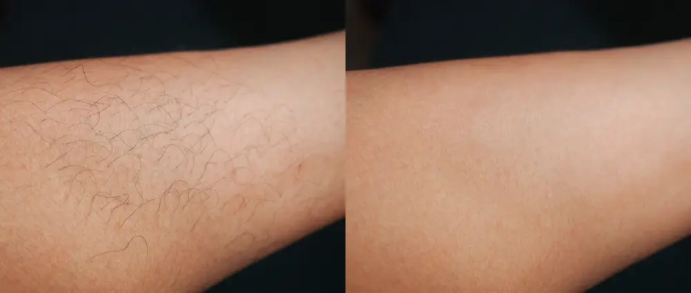 a close up of a person's arm
